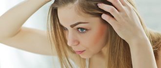 Выпадение волос: причины и восстановление
