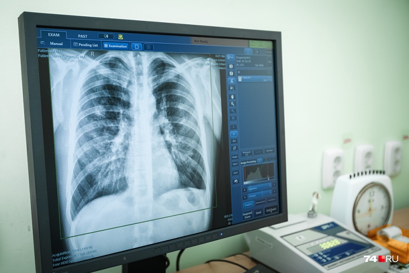 Флюорографическое обследование лёгких